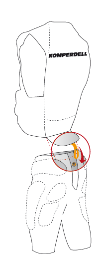 Loop-Button fixation